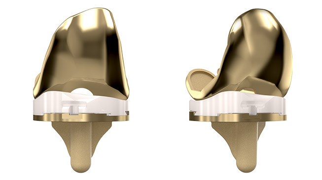Evolution® NitrX™ Medial-Pivot Knee System