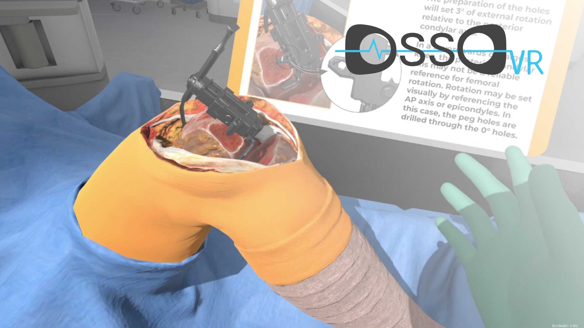 OssoVR